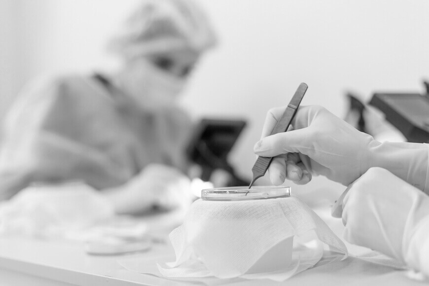 Natural Hair Transplant Medical Center gallery photo
