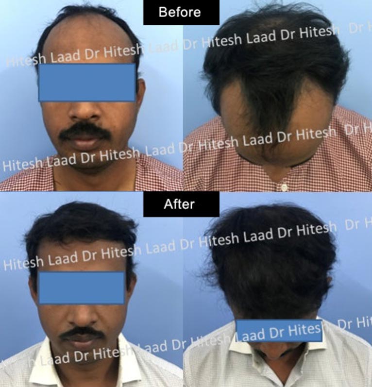 Authentic Hair Transplant and Cosmetic Centre gallery photo