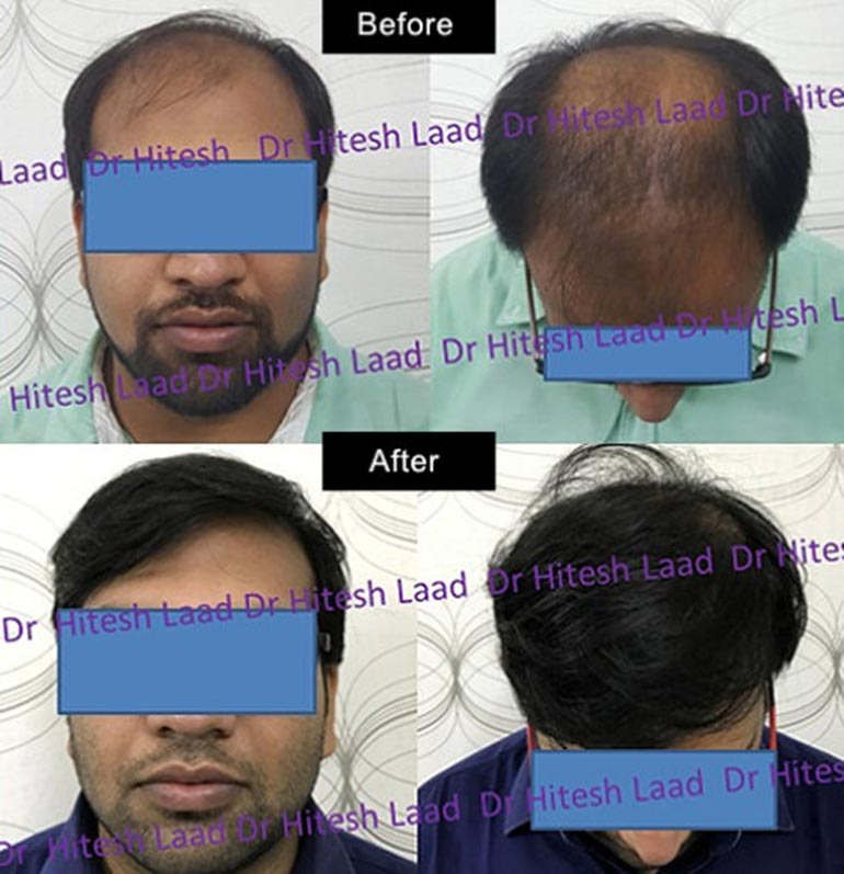 Authentic Hair Transplant and Cosmetic Centre gallery photo