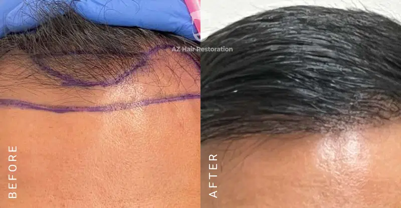 AZ Hair Restoration Clinic Raleigh gallery photo