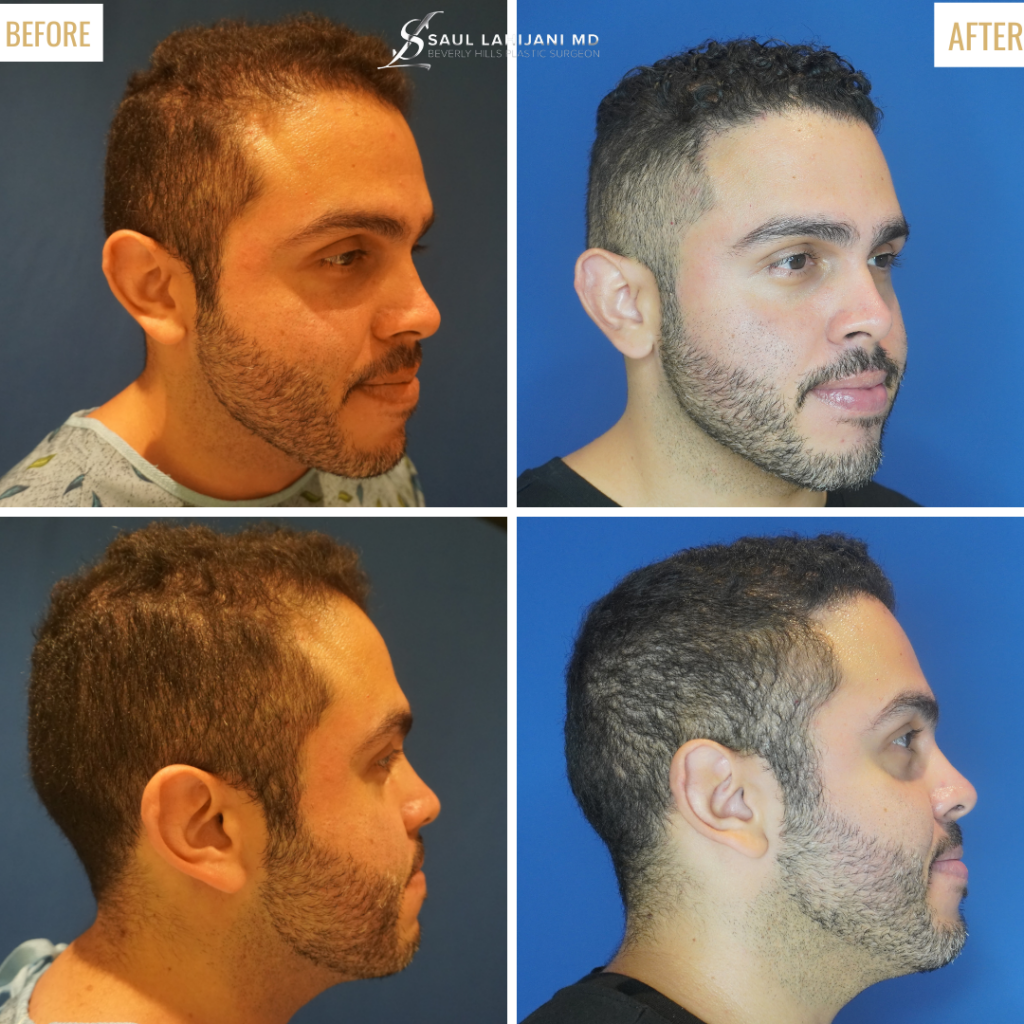 Beverly Hills Hair Center gallery photo