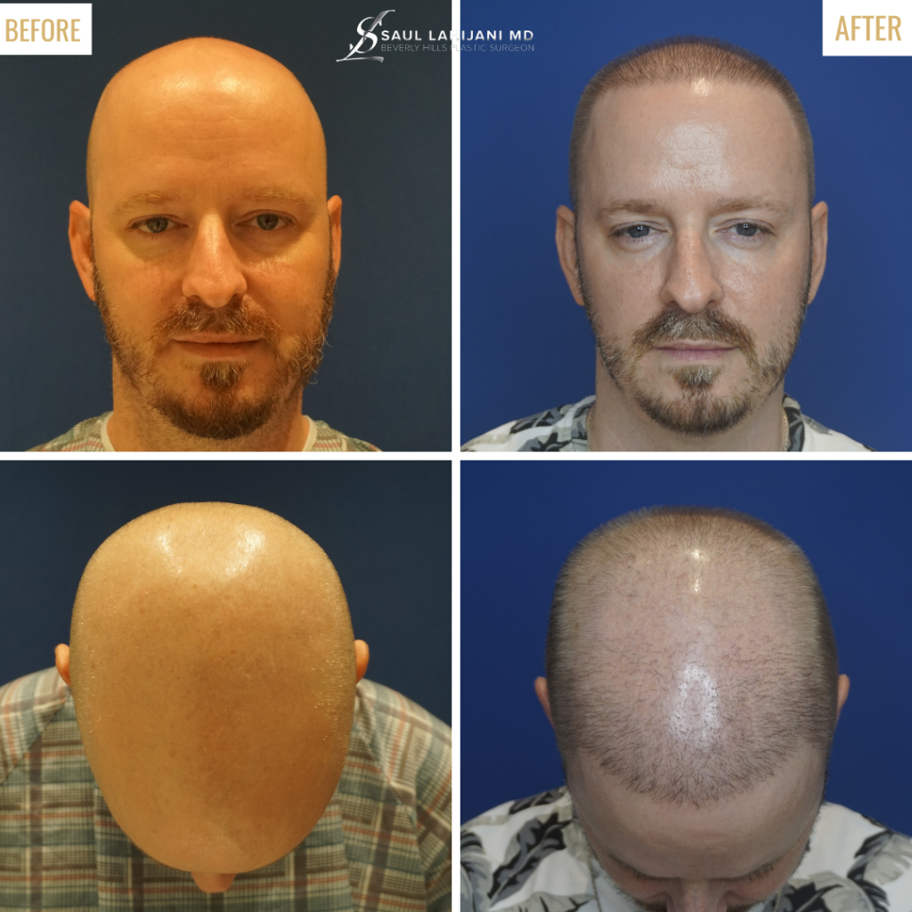 Beverly Hills Hair Center gallery photo