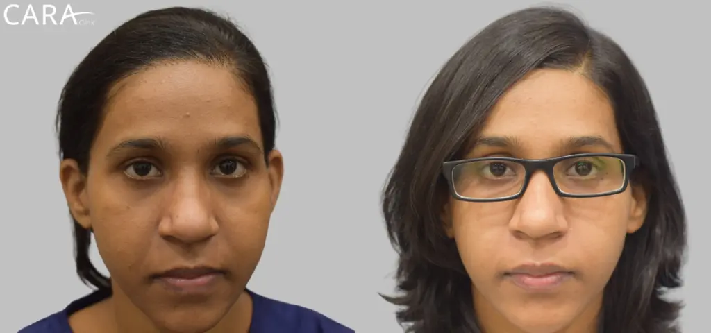 CARA Hair Transplant & Aesthetic Clinic Mumbai gallery photo