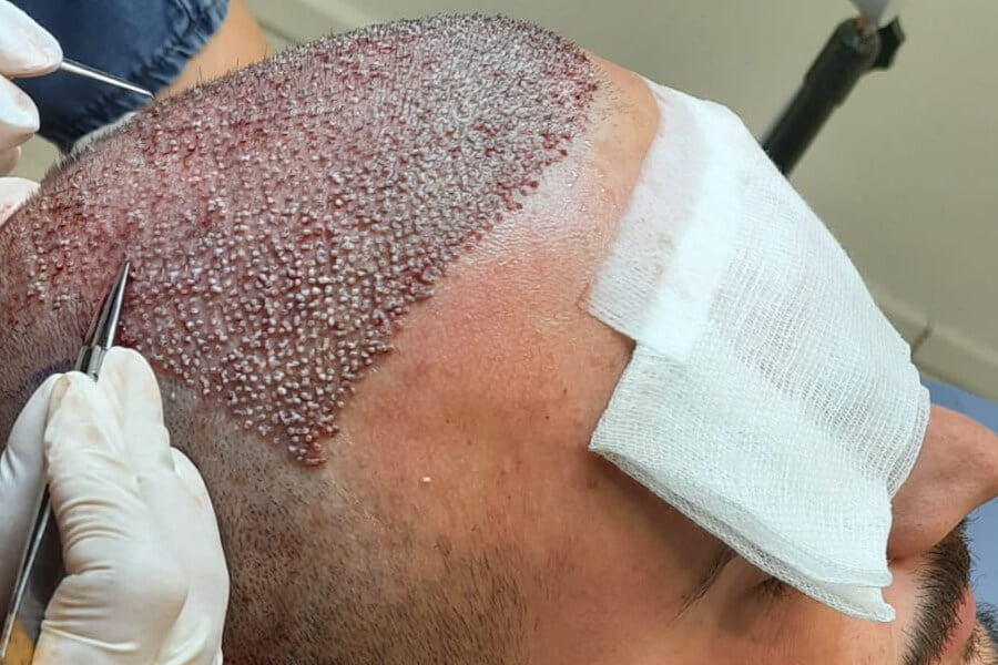 REGENIX ( Best Hair Transplant and Aesthetic Clinic in Lahore ) gallery photo