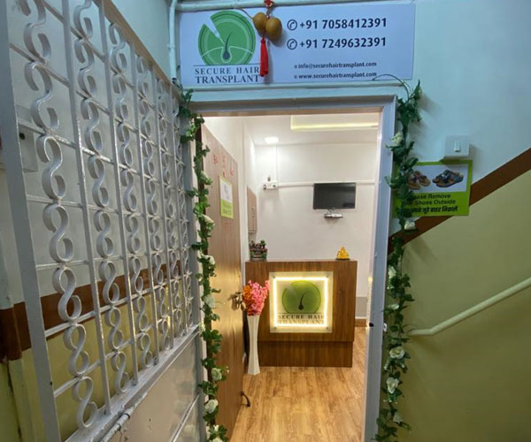 Secure Hair Transplant gallery photo