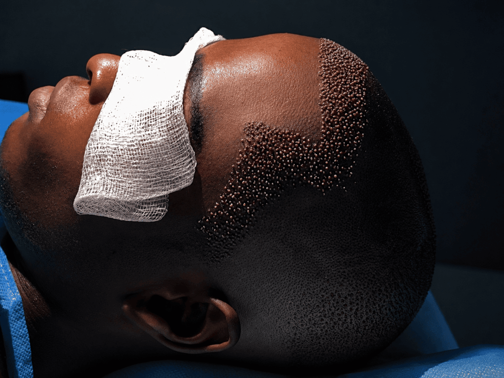 Sandton Hair Transplant Clinic gallery photo