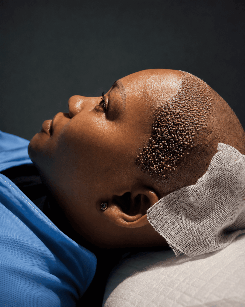 Sandton Hair Transplant Clinic gallery photo