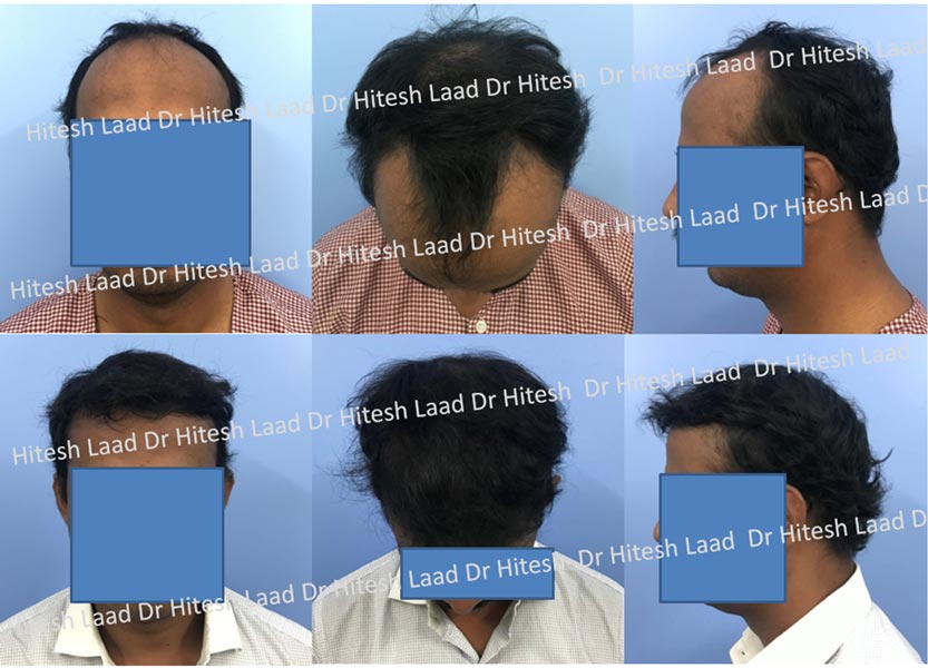 Authentic Hair Transplant and Cosmetic Centre gallery photo