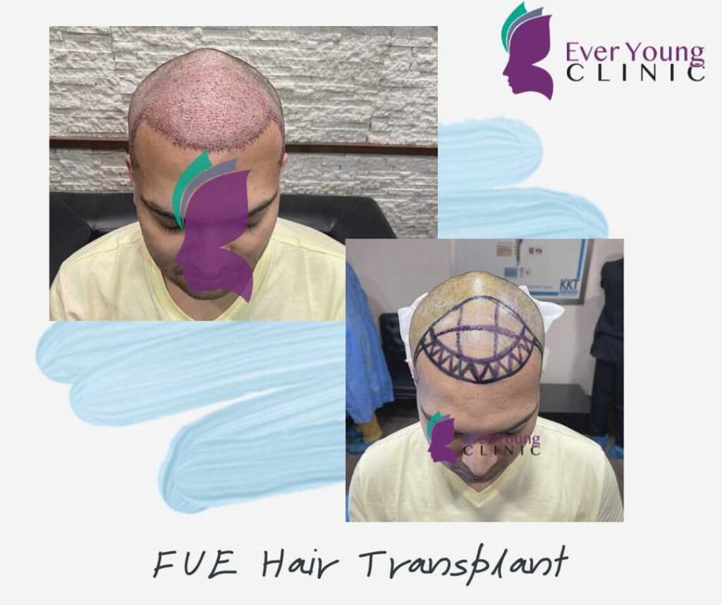Ever Young Hair Restoration Clinic – Dr. Wajeeha gallery photo