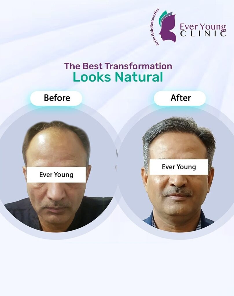 Ever Young Hair Restoration Clinic – Dr. Wajeeha gallery photo