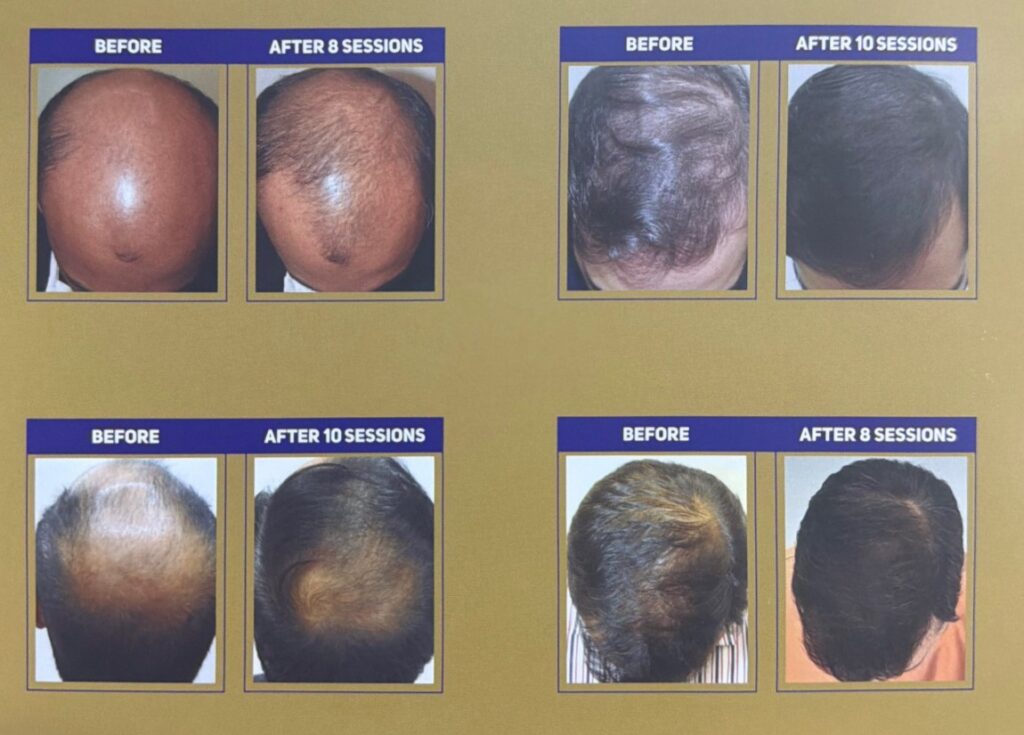 Thrive Hair Clinic gallery photo