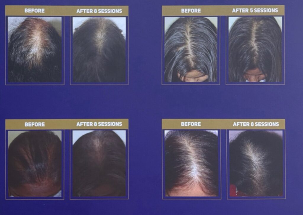 Thrive Hair Clinic gallery photo