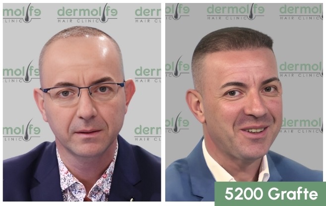 Dermolife Hair Clinic Albania gallery photo