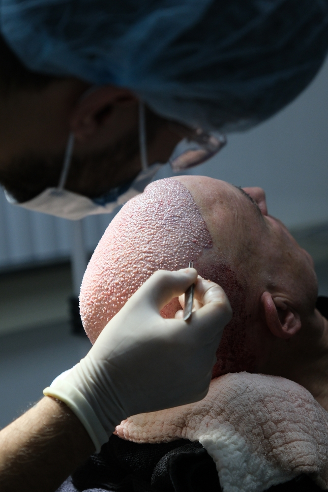 Follicle Hair Clinic Jaipur gallery photo