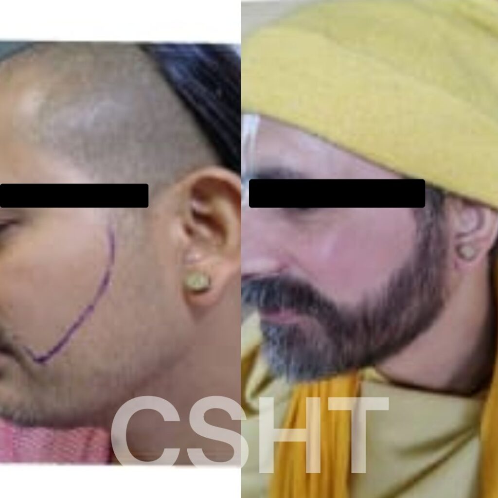 Dr Chandrashekhar Hair Transplant Clinic Mumbai gallery photo