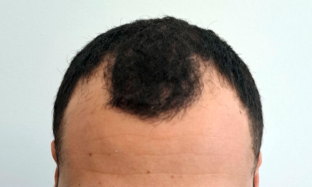 Dr Figura Medical Hair Athens gallery photo