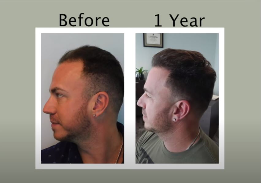 Natural Transplants, Hair Restoration Clinic — clinic photo from Google Maps