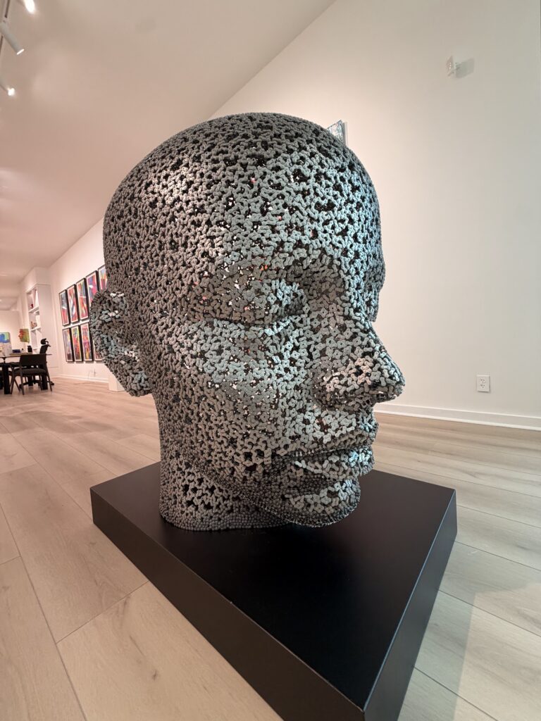 Miami Hair Transplant gallery photo