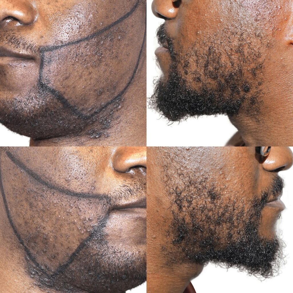 Maxim Hair Restoration & Transplants – Phoenix gallery photo