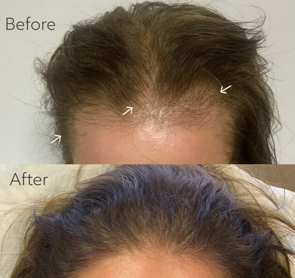 New England Center for Hair Restoration gallery photo