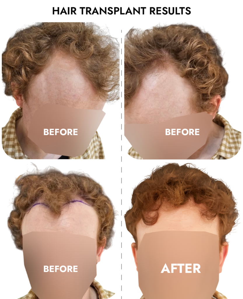 Ailesbury Hair Clinic gallery photo