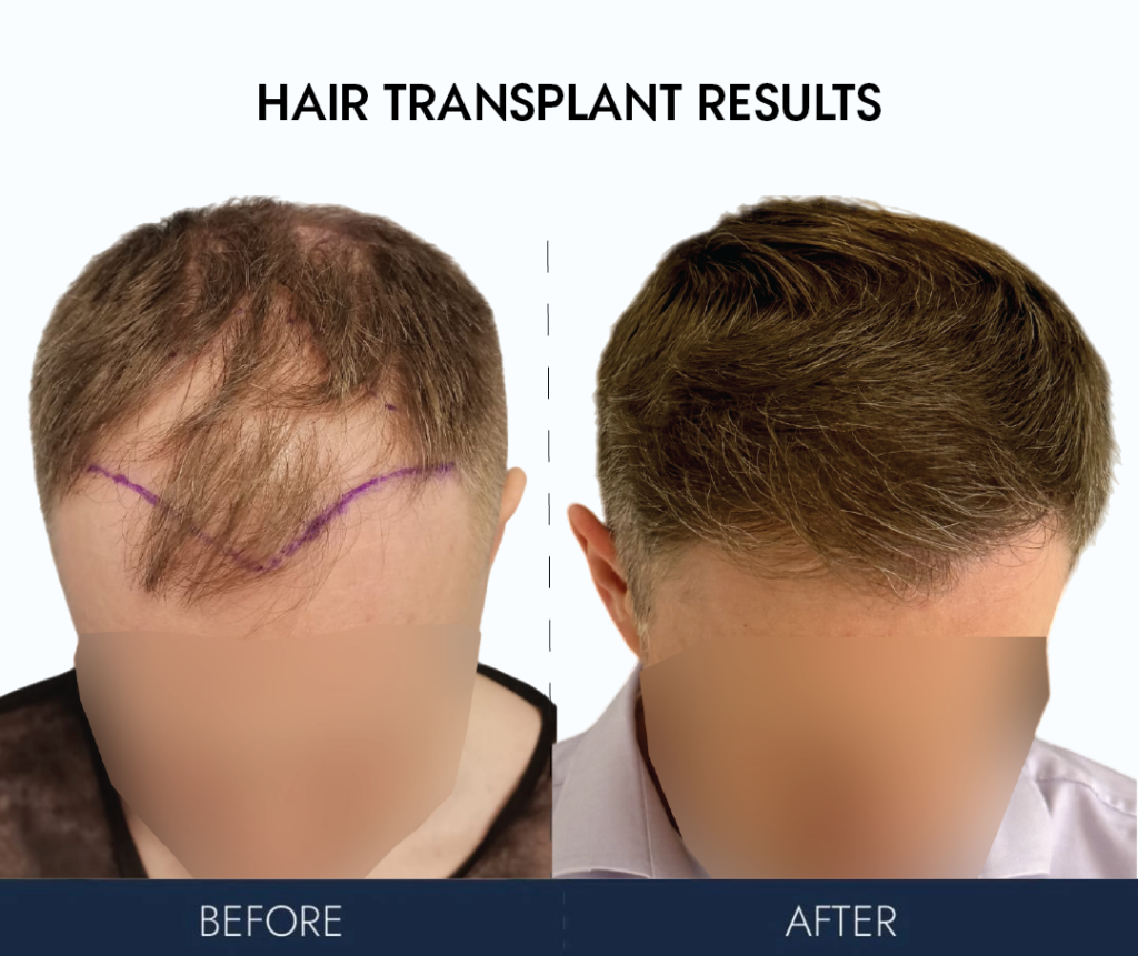 Ailesbury Hair Clinic gallery photo