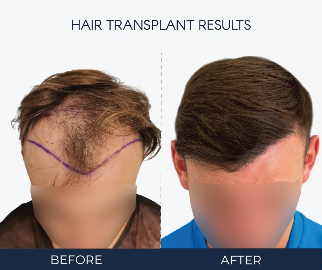 Ailesbury Hair Clinic gallery photo