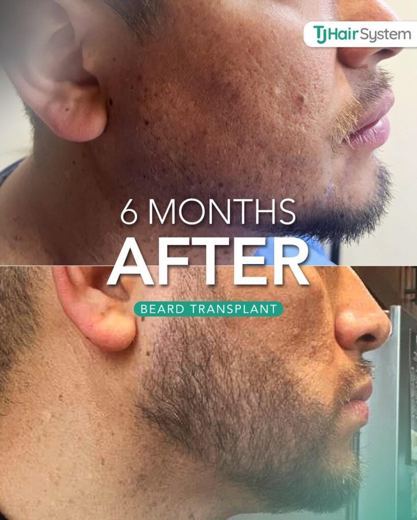 TJ Hair System gallery photo