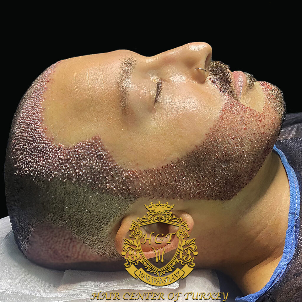 Hair Center Of Turkey — clinic photo from Google Maps