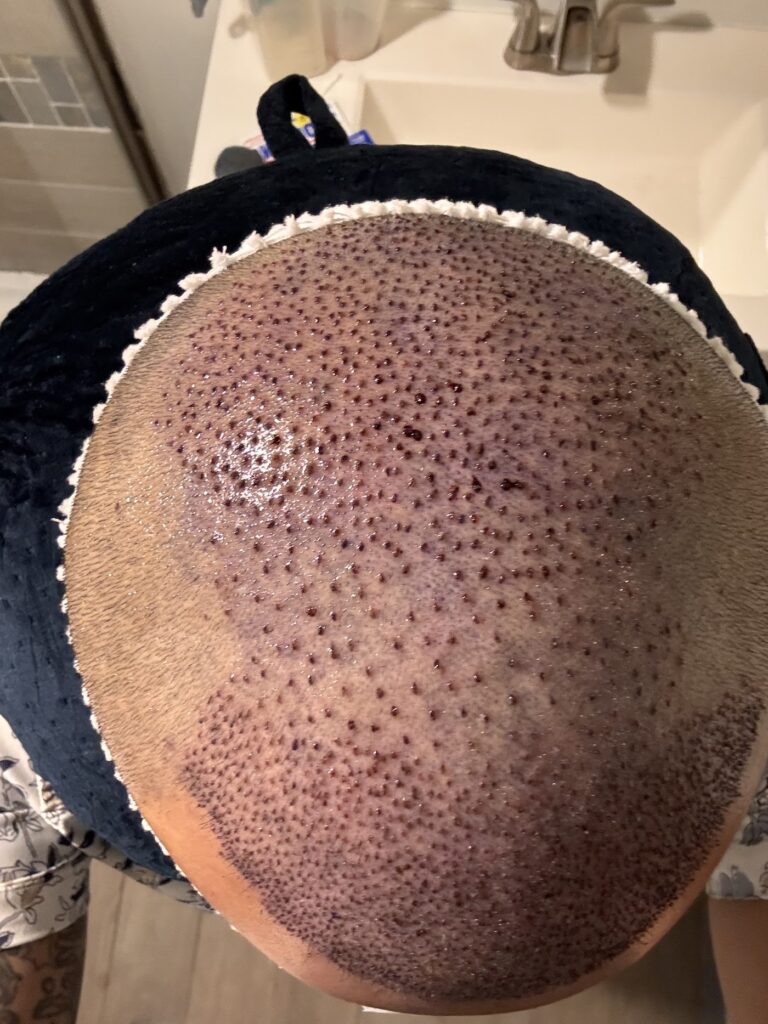 Austin Hair Restoration Clinic gallery photo