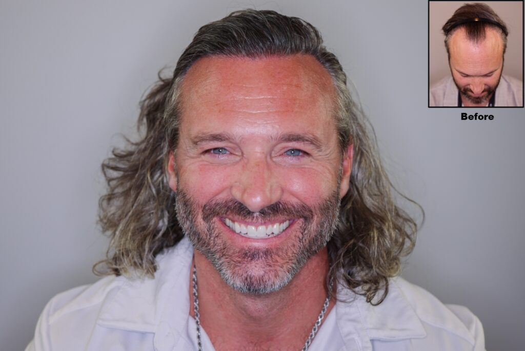 Alvi Armani – Beverly Hills FUE Hair Transplant Clinic — clinic photo from Google Maps