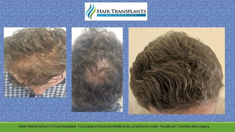 Hair Transplants of Florida — clinic photo from Google Maps