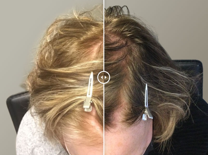 MassDerm Hair Transplant Institute gallery photo