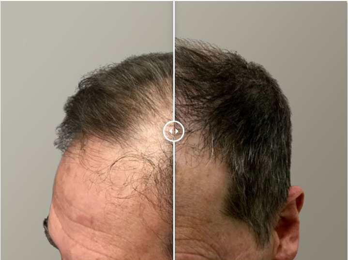 MassDerm Hair Transplant Institute gallery photo