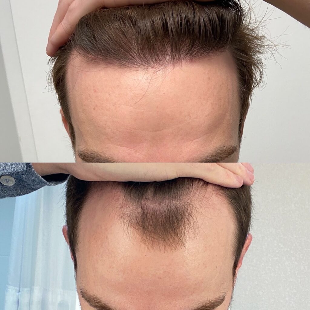 Hair 4 Life Medical gallery photo