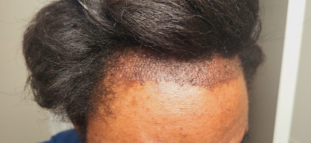 Hair 4 Life Medical gallery photo