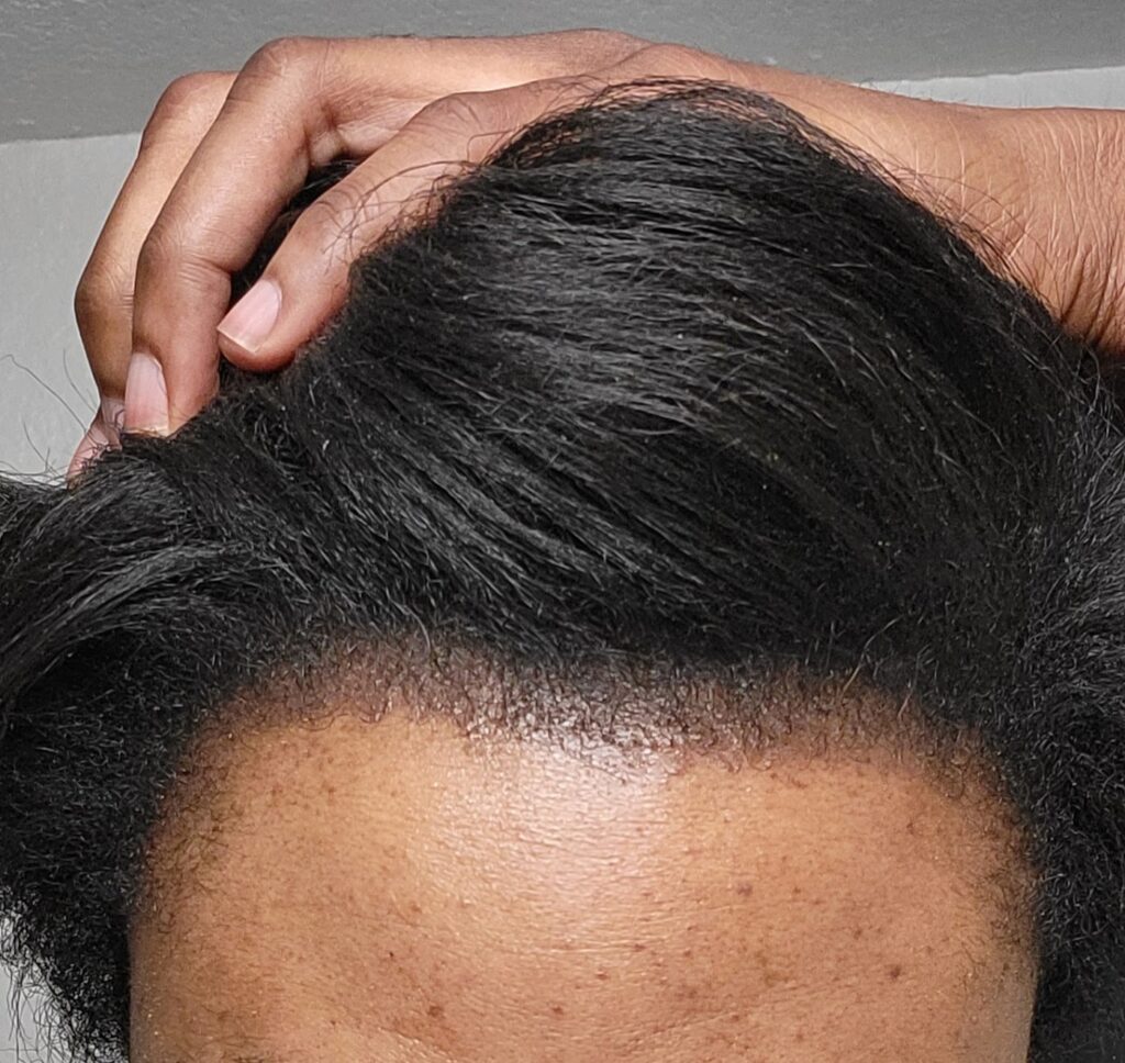 Hair 4 Life Medical gallery photo