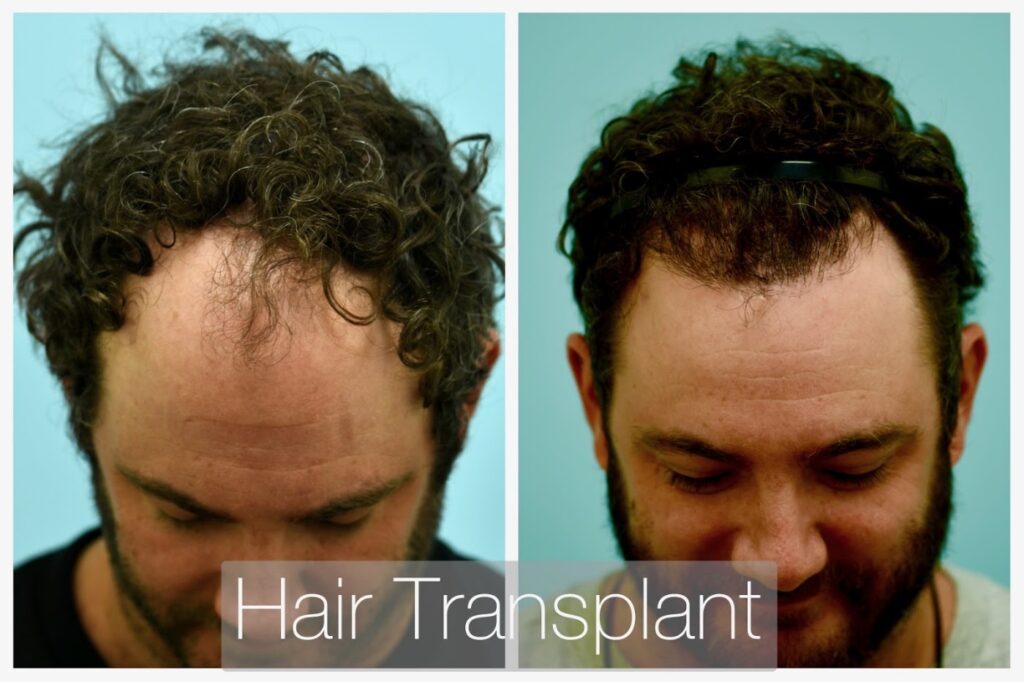 Lam Institute for Hair Restoration – Samuel M. Lam, MD, FACS FISHRS gallery photo