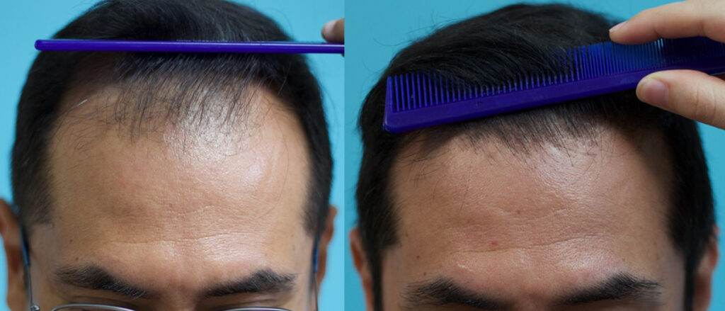 California Hair Surgeon gallery photo