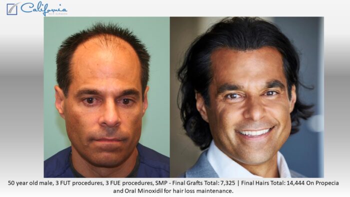California Hair Surgeon gallery photo