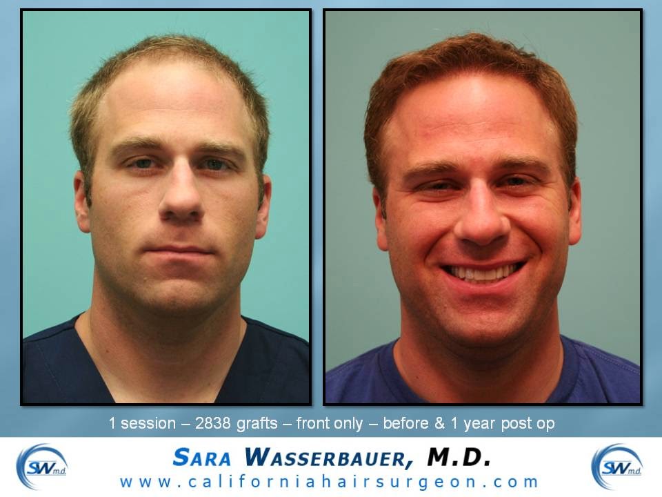California Hair Surgeon gallery photo