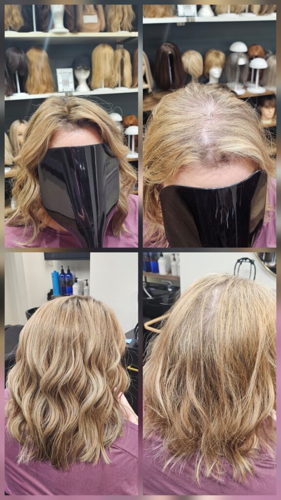 Hair Loss Solutions — clinic photo from Google Maps