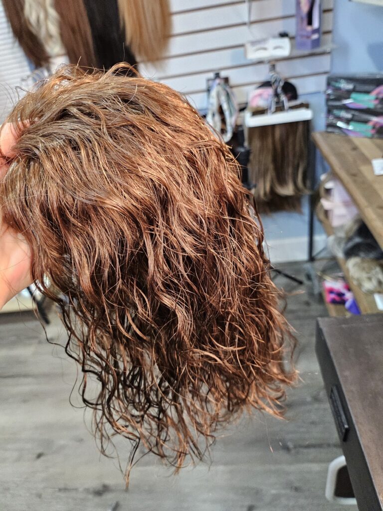 Hair Loss Solutions gallery photo