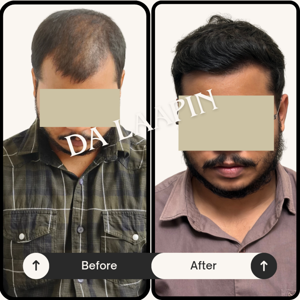 DA LAAPIN Hair Restoration Center — clinic photo from Google Maps