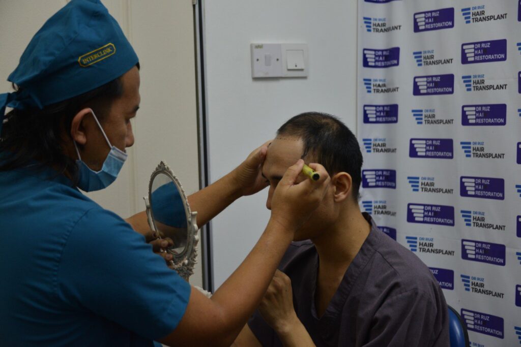 Dr Ruz Hair Transplant gallery photo