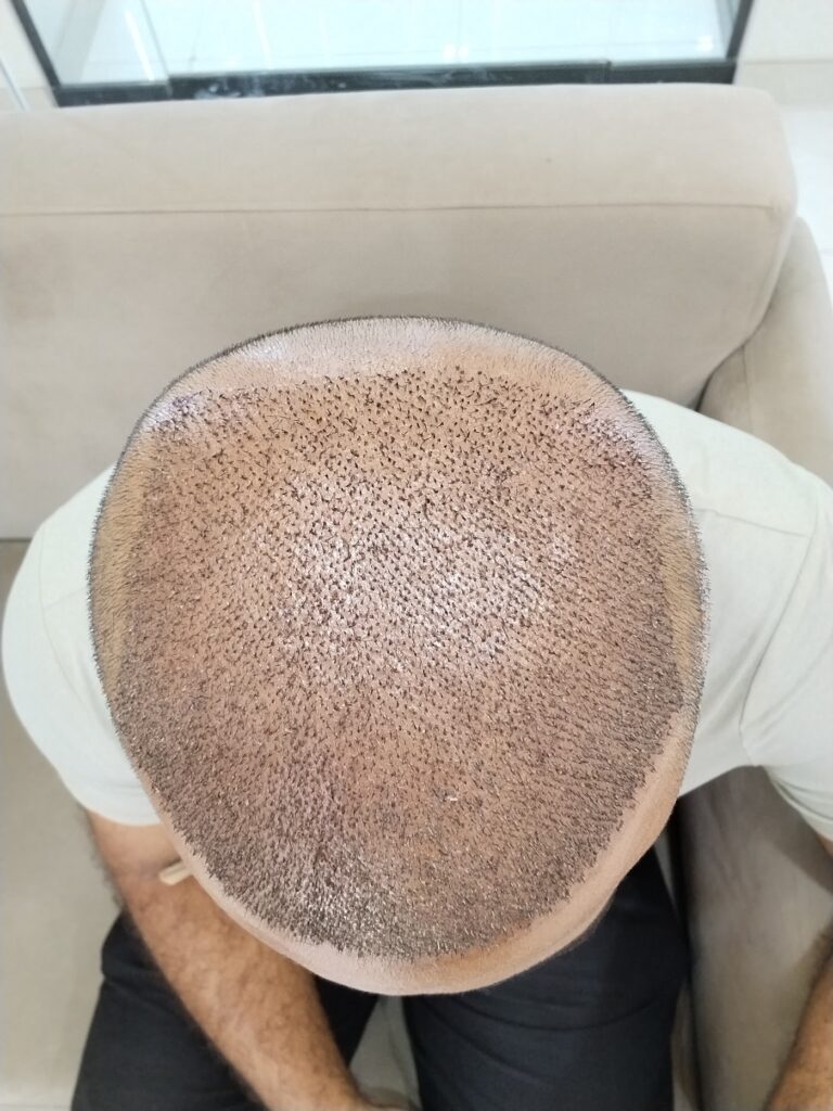 HairCare Aesthetic & Hair Transplant Clinic gallery photo