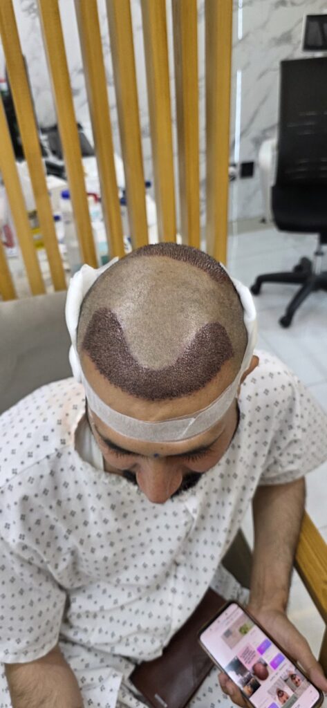 HairCare Aesthetic & Hair Transplant Clinic gallery photo