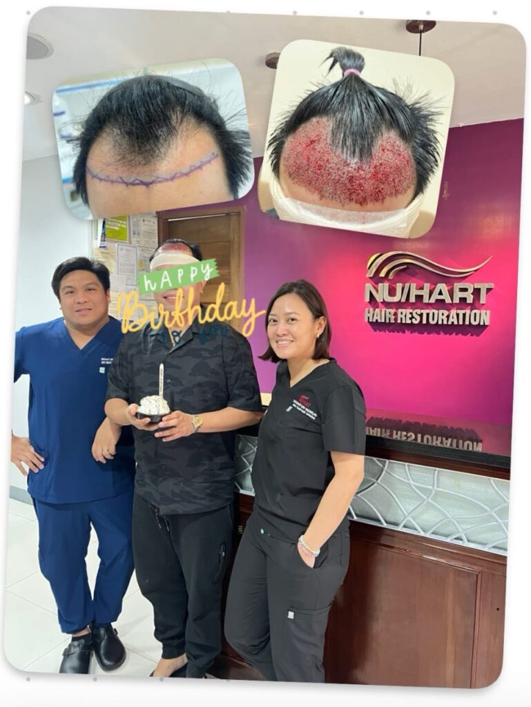 Nu/Hart Hair Restoration Cebu gallery photo