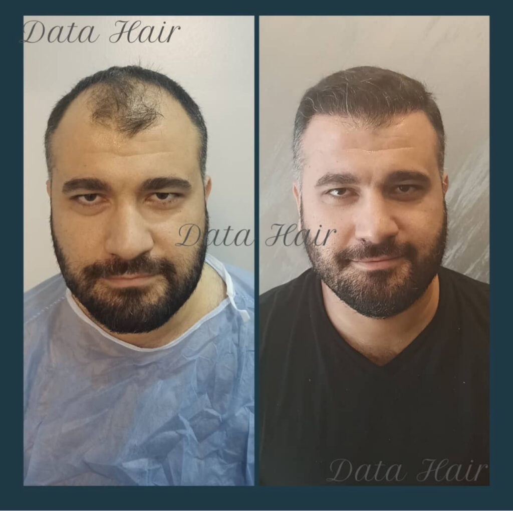 Data Hair Clinic & Eyyüp Tütüncü Saç Ekim Merkezi — clinic photo from Google Maps