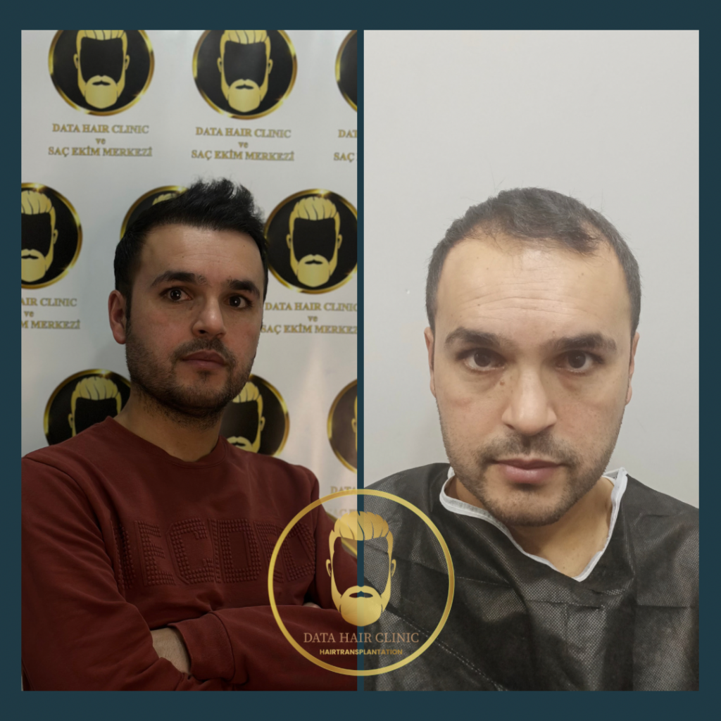Data Hair Clinic & Eyyüp Tütüncü Saç Ekim Merkezi gallery photo